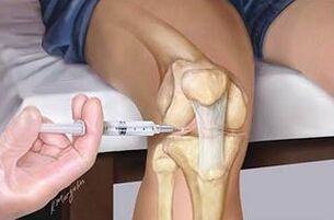 Injection par Hyaluron